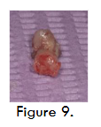 Figure 9- Bone biopsy collected for histological evaluation at 4 months