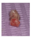 Figure 9- Bone biopsy collected for histological evaluation at 4 months