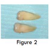 Figure 2 - Extracted teeth cleaned of debris, calculus and PDL