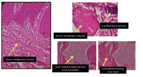 Figure 8: H&E staining at 40X magnification