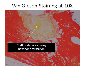 Figure 9: Special stain Van Gieson