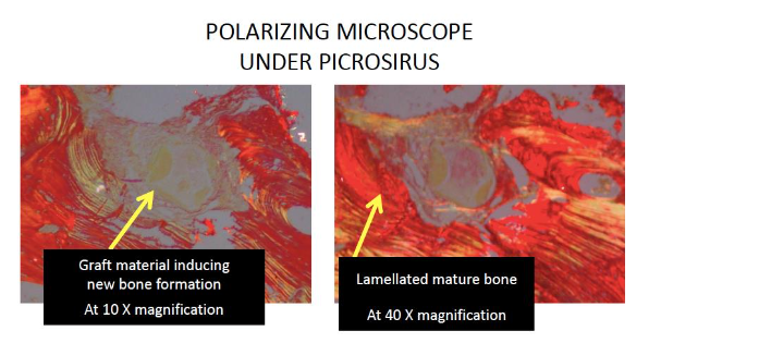 Figure 11: Polarizing microscopy (Picrosirus Red)