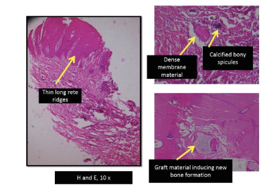 Figure 7: H&E staining at 10X magnification