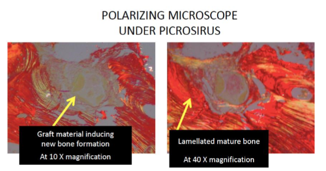 Figure 11: Polarizing microscopy (Picrosirus Red)