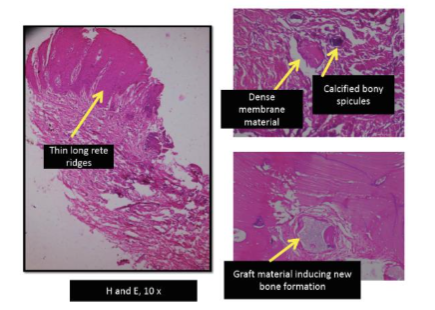 Figure 7: H&E staining at 10X magnification