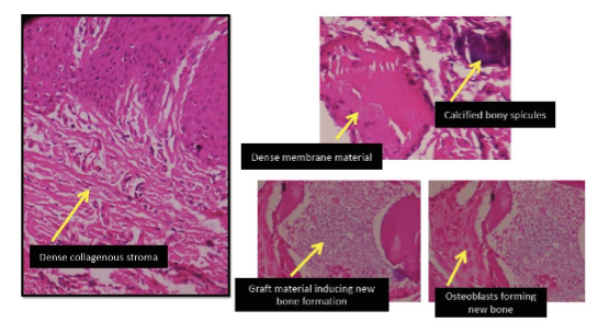 Figure 8: H&E staining at 40X magnification