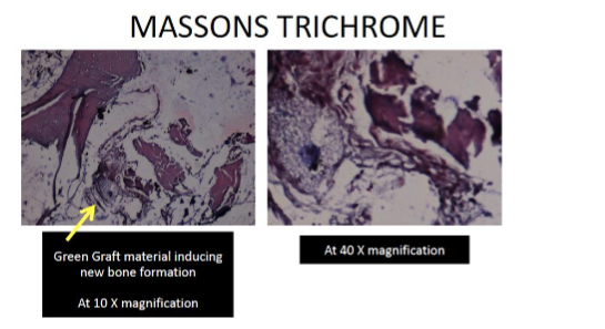Figure 10: Special stain Massons Trichrome