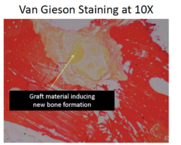 Figure 9: Special stain Van Gieson