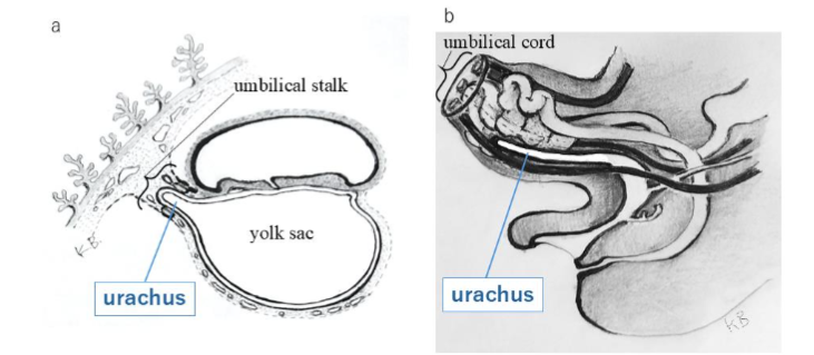 Figure 9. Development of the Urachus.