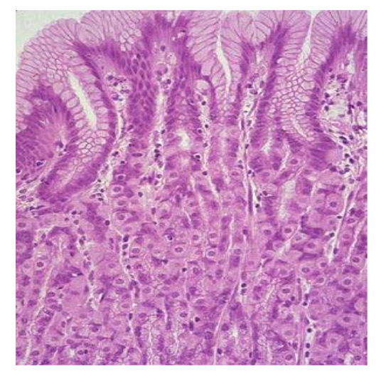 The image shows some of the specialized cells of the gastrointestinal tract (fundic glands) that have the function of degrading food and liquids, especially water, as well as their subsequent absorption. The main location of melanin granules (melanosomes) is around the cell nucleus, so every cell nucleus we observe is a tiny vacuum pump that attracts isotonic water constantly, both day and night, and for a lifetime. (Source of slide: Lumen)