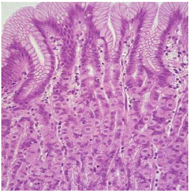 The image shows some of the specialized cells of the gastrointestinal tract (fundic glands) that have the function of degrading food and liquids, especially water, as well as their subsequent absorption. The main location of melanin granules (melanosomes) is around the cell nucleus, so every cell nucleus we observe is a tiny vacuum pump that attracts isotonic water constantly, both day and night, and for a lifetime.
