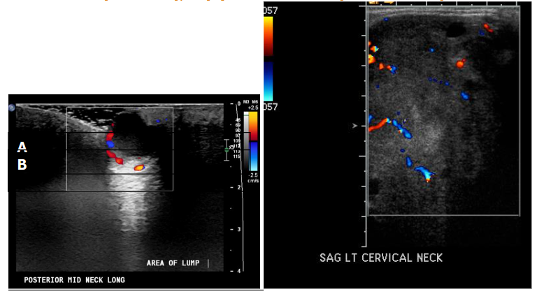 Imaging Skin Lesions: CT, MRI, Ultrasound, and PET Insights - European ...