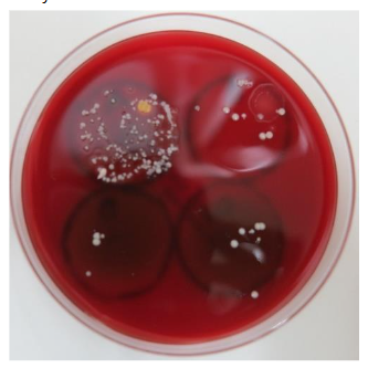 Figure 2. Offensive disinfection activity of tobacco and incense stick smoke. Stamp cultures of test plates on agar medium; ten vocalizations (“Ba, Bi, Bu, Be, Bo, Pa, Pi, Pu, Pe, and Po”) onto sterilized plastic plates placed 20~30cm from the mouth resulted in the formation of approximately 150CFU of bacteria and fungi. Biomass smoke from tobacco and incense sticks suppressed colony formation to a similar extent as electrolyzed saline.