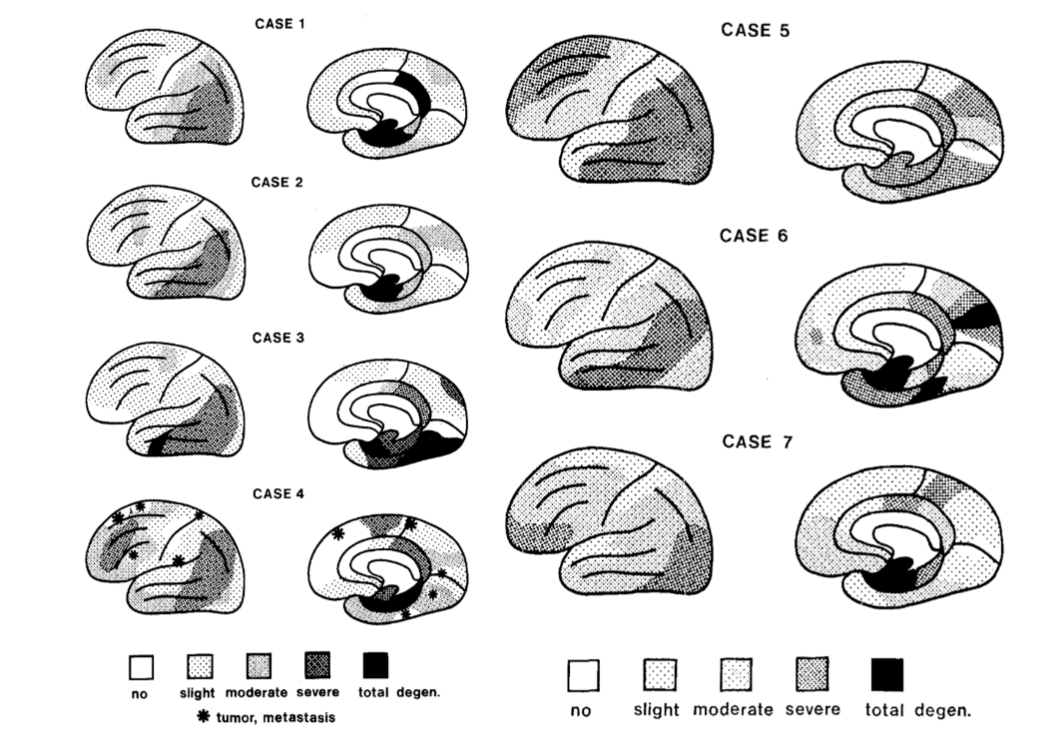 Figure 1. The distribution of histopathology in Alzheimer’s disease. From: Brun A, Gustafson L. Distribution of cerebral degeneration in Alzheimer's disease. A clinico-pathological study. Arch Psychiatr Nervenkr 1976;223:15-33.
