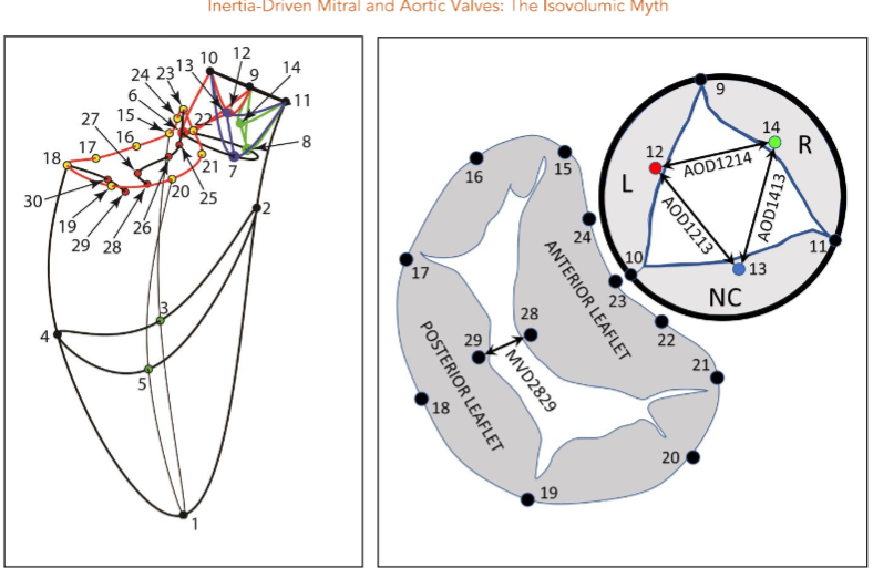 Figure 1: Mitral valve annulus marker placement: Left Panel: Implantation sites for the 30 radiopaque markers employed. Right Panel: Enlarged schematic showing markers employed for anatomical locations.