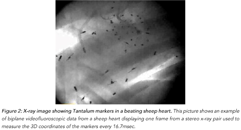 Figure 2: X-ray image showing Tantalum markers in a beating sheep heart. This picture shows an example of biplane videofluoroscopic data from a sheep heart displayed in a frame from a stereo x-ray pair used to measure the 3D coordinates of the markers every 16.7 msec.