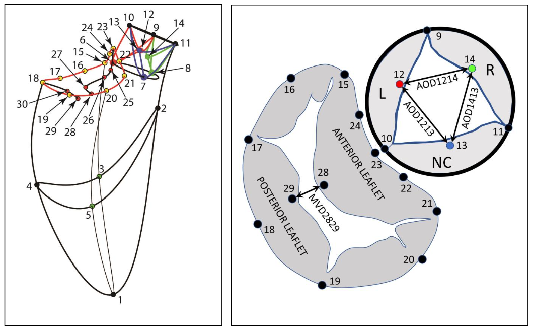 Figure 1: Mitral valve annulus marker placement: Left Panel: Implantation sites for the 30 radiopaque markers employed. Right Panel: Enlarged schematic showing markers employed for anatomical locations.