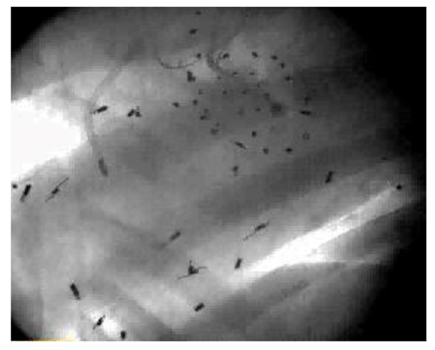 Figure 2: X-ray image showing Tantalum markers in a beating sheep heart. This picture shows an example of biplane videofluoroscopic data from a sheep heart used to measure the 3D coordinates of the markers every 16.7 msec.