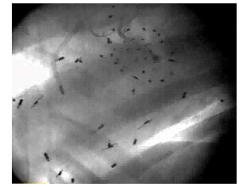 Figure 2: X-ray image showing Tantalum markers in a beating sheep heart. This picture shows an example of biplane videofluoroscopic data from a sheep heart.