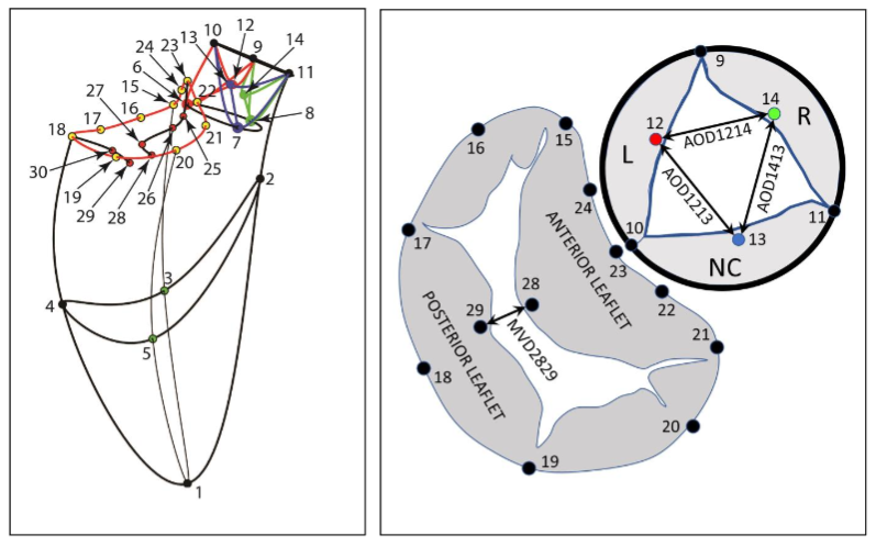 Figure 1: Mitral valve annulus marker placement: Left Panel: Implantation sites for the 30 radiopaque markers employed. Right Panel: Enlarged schematic showing markers employed for anatomical locations.