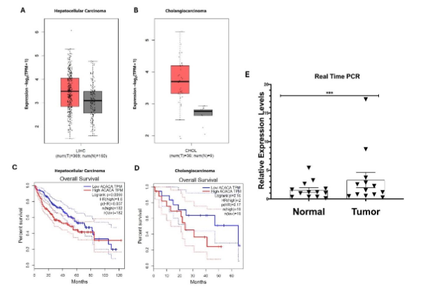 GEPIA data of ACC1 expression in HCC (A) and CCA (B) tumor and normal tumor-adjacent cells. Kaplan-Meier curve of HCC (C) and CCA (D) patients with high and low ACC1 expression. ACC1 expression was seen to be negatively correlated with patient survival. (E) The mRNA expression levels of ACC1 were assessed in human liver tumor tissue samples and adjacent normal tissue samples. A significant increase in relative ACC1 expression was observed in the tumor tissue samples compared to normal tissue samples.