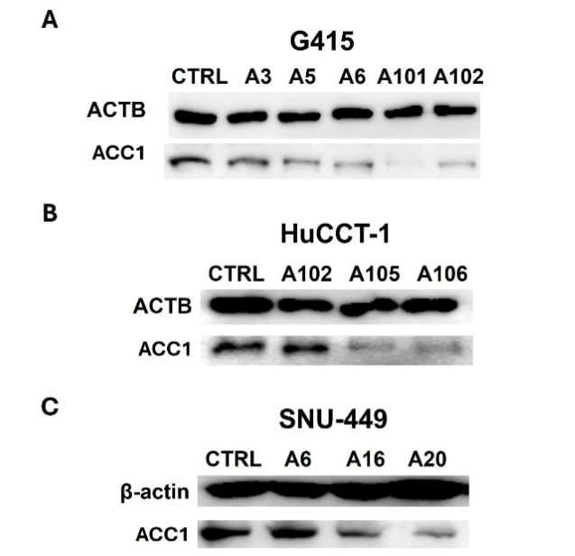 Western blot analysis illustrating the expression levels of ACC1 in (A) G415, (B) HuCCT-1, and (C) SNU-449 control cells compared to ACC1 knockdown cell clones. ACC1 knockdown resulted in a notable reduction in ACC1 expression across all cell lines.