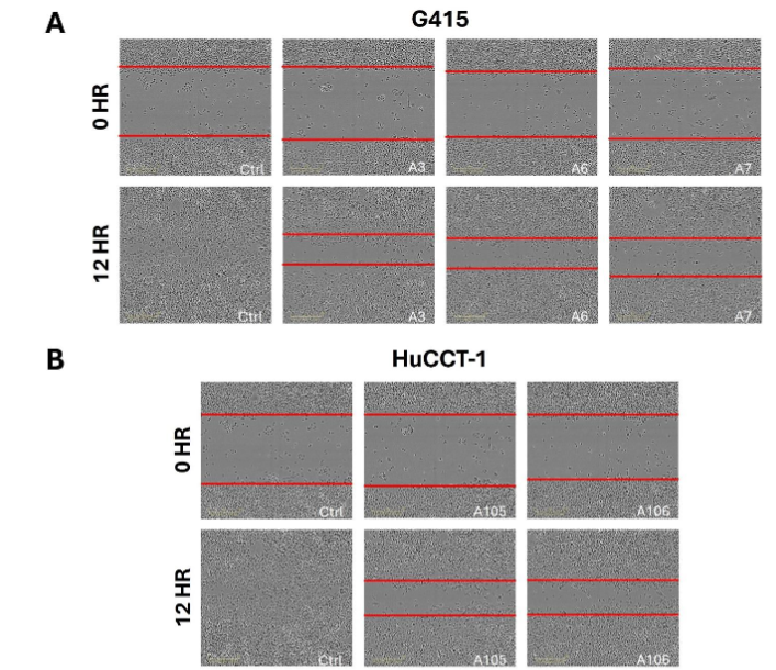 A Scratch Wound Assay was conducted on (A) G415 and (B) HuCCT-1 cell lines. In both cases, ACC1 knockdown led to a notable decrease in cellular migration and impaired wound healing compared to control conditions.