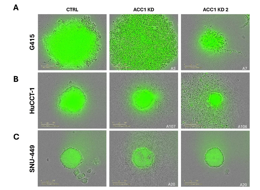 Figure 5. 3D spheroid assays were conducted in (A) G415, (B) HuCCT-1, and (C) SNU-449 cell lines, with spheroid growth monitored over three days using the IncuCyte Imaging incubator. Knockdown of ACC1 resulted in a notable decrease in spheroid growth, diameter, and/or cellular density across the tested cell lines compared to controls.