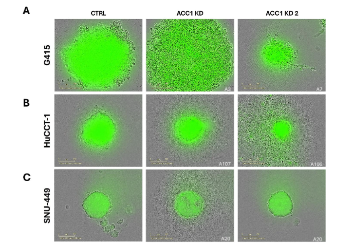 3D spheroid assays were conducted in (A) G415, (B) HuCCT-1, and (C) SNU-449 cell lines, with spheroid growth monitored over three days using the IncuCyte Imaging incubator. Knockdown of ACC1 resulted in a notable decrease in spheroid growth, diameter, and/or cellular density across the tested cell lines compared to controls.