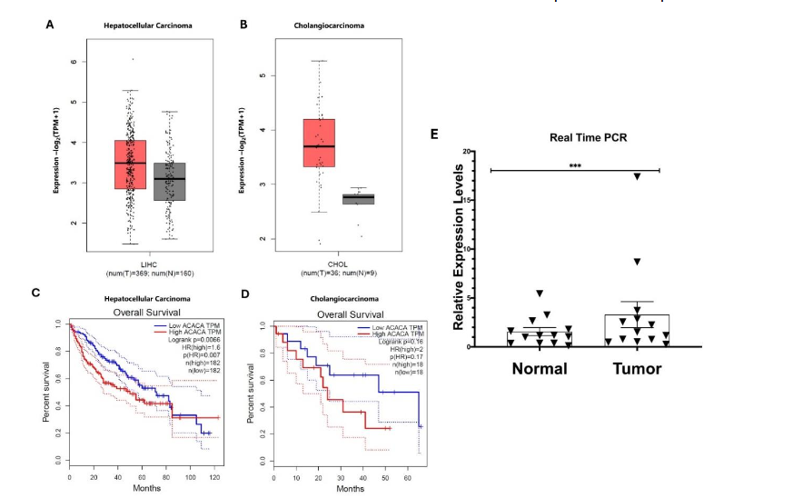 Figure 1. GEPIA data of ACC1 expression in HCC (A) and CCA (B) tumor and normal tumor-adjacent cells. Kaplan-Meier curve of HCC (C) and CCA (D) patients with high and low ADCK1 expression. ACC1 expression was seen to be negatively correlated with patient survival. (E) The mRNA expression levels of ACC1 were assessed in human liver tumor tissue samples and adjacent normal tissue samples. A significant increase in relative ACC1 expression was observed in the tumor tissue samples compared to normal tissue samples.