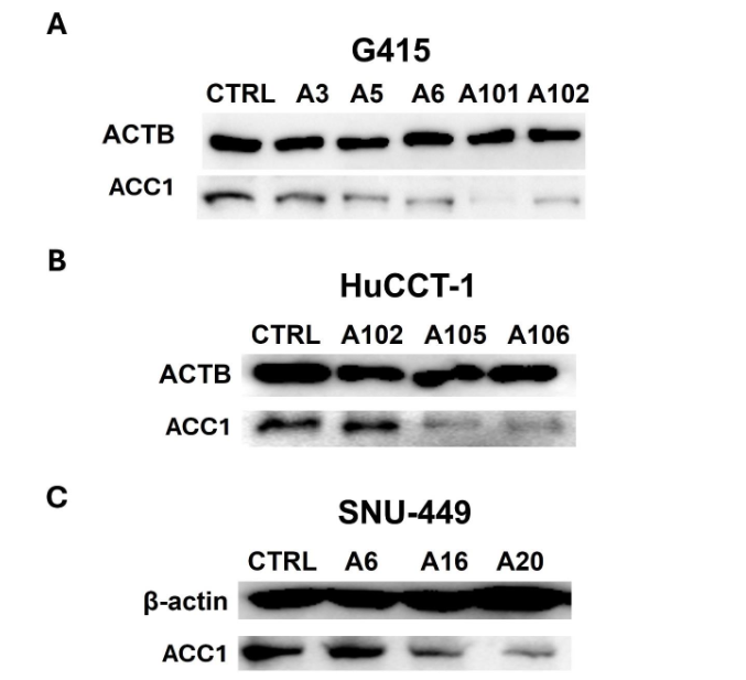 Figure 2. Western blot analysis illustrating the expression levels of ACC1 in (A) G415, (B) HuCCT-1, and (C) SNU-449 control cells compared to ACC1 knockdown cell clones. ACC1 knockdown resulted in a notable reduction in ACC1 expression across all cell lines.