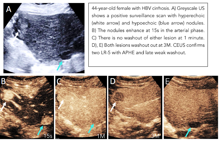 Figure 1: Positive Surveillance scan