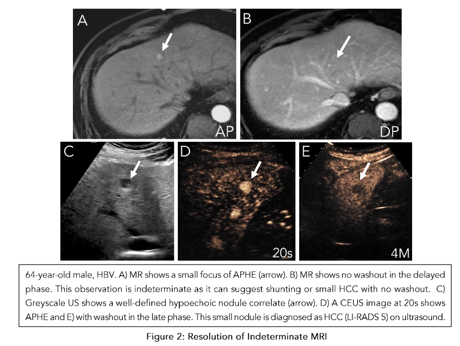Figure 2: Resolution of Indeterminate MRI