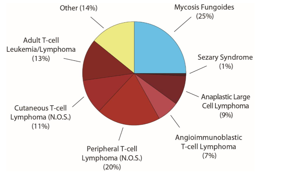 Figure 2. Frequencies of T-cell Non-Hodgkin Lymphomas. Indolent T-cell lymphomas are in blue shades, while aggressive T-cell lymphomas are signified by red shades. The “other” categorization includes precursor forms of NHL and T-cell lymphomas under 1% prevalence. Data is based on percentages from the National Cancer Institute’s Surveillance, Epidemiology and End Results (SEER) data, 2008-2017.
