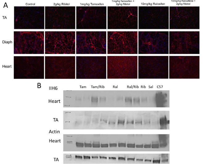 Figure 1. Matriglycan expression detected by IIH6 staining in tibialis anterior (TA), diaphragm (Diaph) and heart of FKRP-P448L mutant mice. A) IIH6 staining of tissue sections. Treatment with 2 g/kg ribitol shows increased expression (membrane localized staining) in all three tissues. Treatment with 1 mg/kg tamoxifen and 10 mg/kg raloxifene shows no clear improvement. Combined tamoxifen and raloxifene treatment with ribitol shows similar increase in IIH6 signal intensity in TA, diaphragm and heart to ribitol alone. B) Western blot.