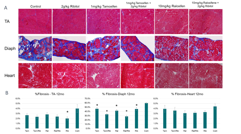Figure 3. Histology of 12 month treated samples from P448L mutant mice. Mason’s Trichrome staining. A) Fibrotic area shown as streaks (stained in blue) in tissue samples from all groups. B) Quantification of fibrosis represented as a percentage of the blue area to total tissue. TA, Tibialis anterior; Diaph, Diaphragm. * = P<0.05 compared to the control.