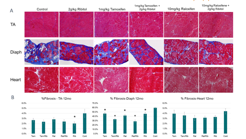 Figure 3. Histology of 12 month treated samples from P448L mutant mice. Mason’s Trichrome staining. A) Fibrotic area shown as streaks (stained in blue) in tissue samples from all groups. B) Quantification of fibrosis represented as a percentage of the blue area to total tissue. TA, Tibialis anterior; Diaph, Diaphragm. * = P<0.05 compared to the control.