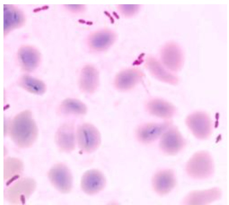 Gram stain showing Burkholderia pseudomallei, a Gram-negative bacillus with characteristic bipolar (‘safety pin’) appearance.