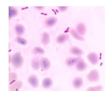 Gram stain showing Burkholderia pseudomallei, a Gram-negative bacillus with characteristic bipolar (‘safety pin’) appearance.