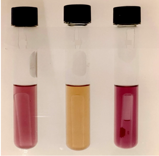 Figure 6: Lactose positive (+) and Lactose negative (–) differential agar showing Lactose positive (+) cultures (large yellow colonies showing on the left plate), Lactose negative (–) cultures (small purple colonies showing in the middle plate), and the mixture of Lactose positive (+) and Lactose negative (–) mixed cultures (showing both Lactose positive (+) large yellow colonies and Lactose negative (–) small purple colonies on the right plate).