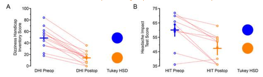 Figure 2. Preoperative (Preop) and postoperative (Postop) Dizziness Handicap Inventory (DHI) scores and Headache Impact Test (HIT-6) scores of 10 patients who underwent middle fossa plugging and resurfacing of their superior semicircular canal dehiscence. The mean age was 32.7 years (SE 3.73, range 13 – 64). There were 7 females and 3 males. A) Individual patient data for preoperative and postoperative DHI scores in the 10 patients included in this study. The preoperative mean DHI score was 48.9 (SE 4.9, range 18 – 84). The postoperative mean DHI score was 14.5 (SE 2.6, range 0 – 36). This improvement was highly statistically significant (Tukey Honest Significant Difference [Tukey HSD], p<0.001). Individual patients are plotted as separate lines (red). B) Individual patient data for preoperative and postoperative HIT-6 scores in 10 patients included in this study. The preoperative mean HIT-6 score was 60.2 (SE 2.7, range 36 – 72). The postoperative mean HIT-6 score was 47.4 (SE 2.2, range 36 – 63). This improvement was highly statistically significant (Tukey HSD, p<0.001). Individual patients are plotted as separate lines (red). Used with permission, copyright © P.A. Wackym, MD