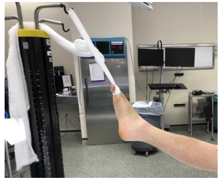 Figure 2: The free ends of the gauze roll are tightened and attached to an IV pole at the end of the hospital bed or operating table to suspend the leg.
