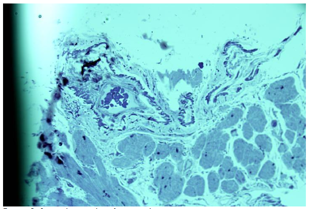 Figure 2. Several arterioles of varying lumen sizes.