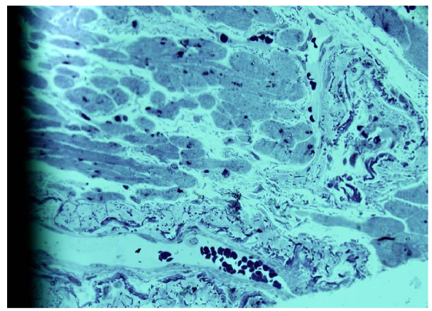 Figure 1. De novo formation in a large arteriole