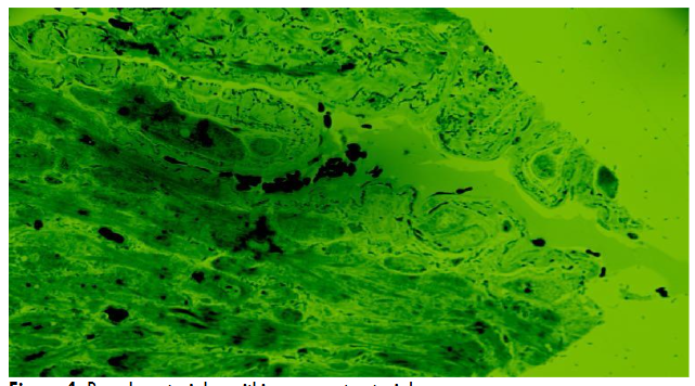 Figure 4. Pseudo-arterioles within a parent arteriole.