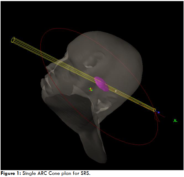 Single ARC Cone plan for SRS.
