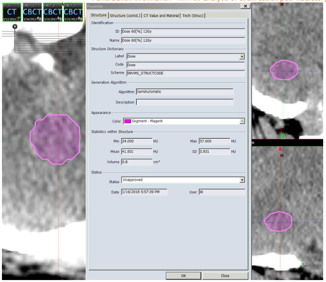 Pixel information of Volume of interest (VOI). It was directly application of the property function of VOI from contouring module from Eclipse Treatment Planning System from Varian Medical System.