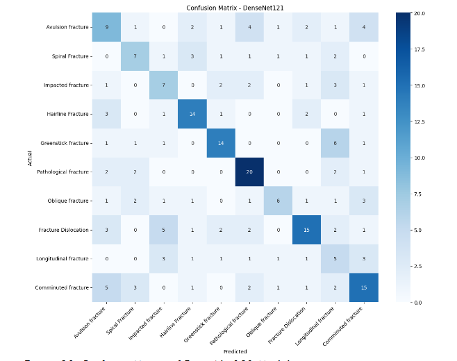 Figure 10: Confusion Matrix of DenseNet121 Model