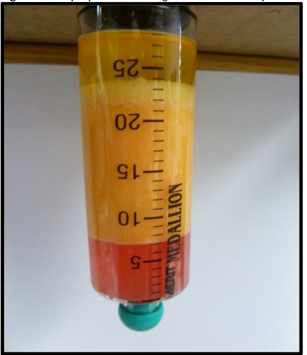 Figure 10B: Close of images of the microcannulas: Top: Multiport Infiltrator close up Middle: Off-Set Spiral Harvester (Carraway) close up Bottom: Single Port Injection (comes in varying lengths and diameter (up to 19 gauge), use in neural or hydro-dissection (PPP) applications and grafting