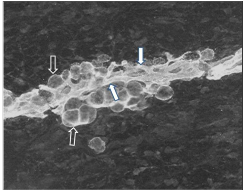 Figure 1: Embryo Fetal Pig Limb Bud
